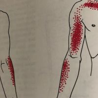 No Crack Chiropractor ico