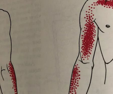 No Crack Chiropractor