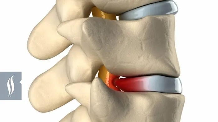 Alignspine Chiropractic Clinic Picture 1