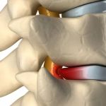 Alignspine Chiropractic Clinic