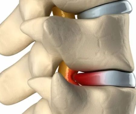 Alignspine Chiropractic Clinic