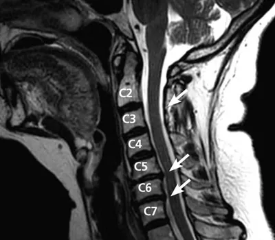 Alignspine Chiropractic Clinic Picture 9