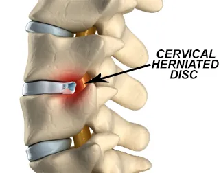 Alignspine Chiropractic Clinic Picture 10