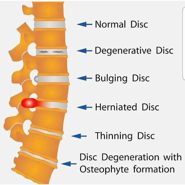 ProActive Chiropractic & Sports Medicine Picture 6