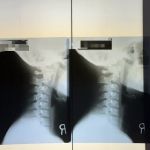 Yonsei Chiropractic Clinic