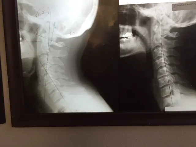 Gonstead Clinics, Dr. Eric Pastrmac, DC, CFMP Picture 8