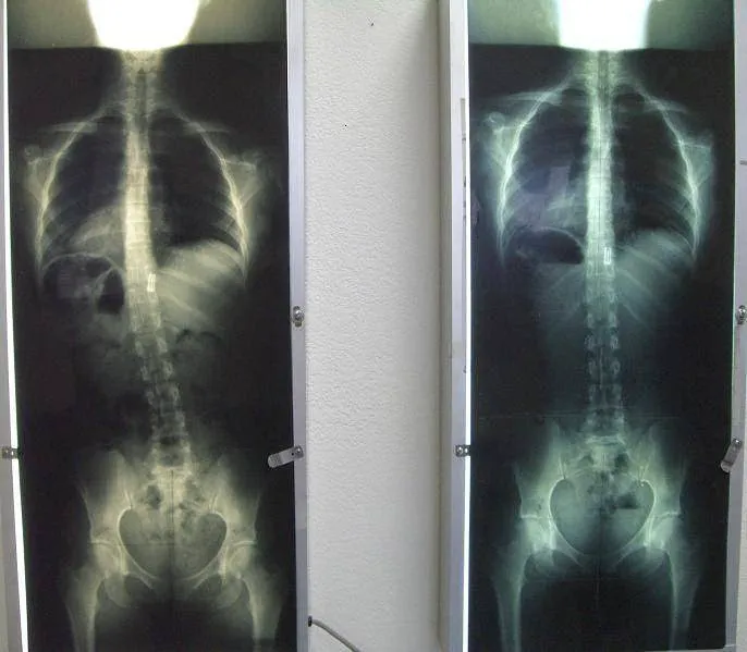 Gonstead Clinics, Dr. Eric Pastrmac, DC, CFMP Picture 4