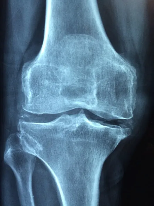 Bates Chiropractic Picture 5