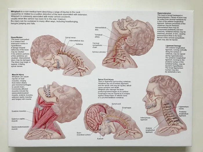 Apex Wellness Chiropractic Picture 4