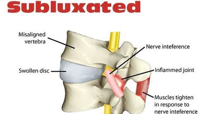 Kian Chiropractic Care Picture 10