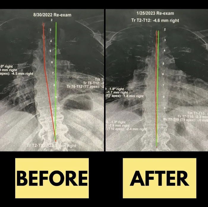 Spinal Performance Picture 8