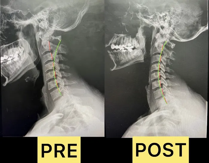 Spinal Performance Picture 7