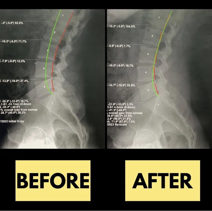 Spinal Performance Picture 9