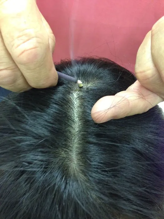 Koyama Chiropractic And Acupuncture Clinic Picture 7