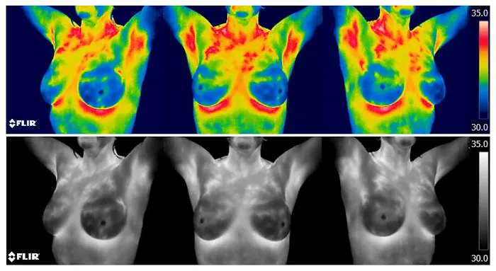 GFCA Wellness Center, Chiropractic & Thermography Picture 6