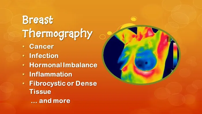 GFCA Wellness Center, Chiropractic & Thermography Picture 8