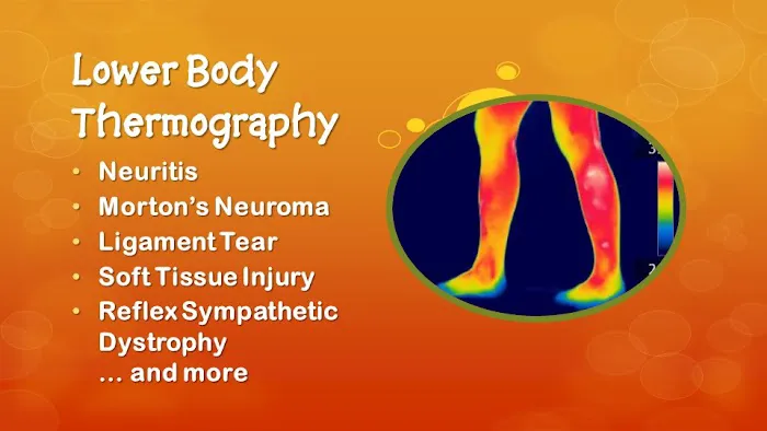 GFCA Wellness Center, Chiropractic & Thermography Picture 9