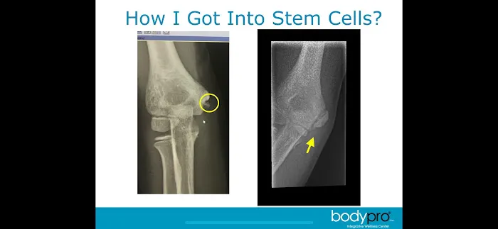 BodyPro Wellness Center - Dr. Tony Ganem, DC Picture 10