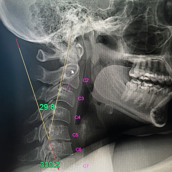 Back To Basics Picture 4