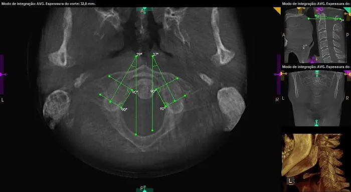 Los Angeles Upper Cervical Picture 10