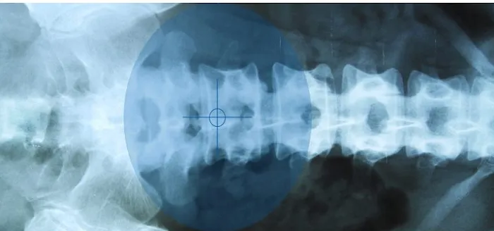 Spine Health Centers Picture 2