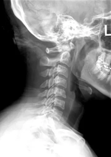 Armani Chiropractic Picture 7