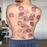 Balance Within - Encino Chiropractor