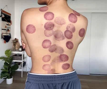 Balance Within - Encino Chiropractor
