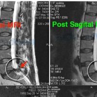 Dr. Bruce Shannahoff, D.C. ico