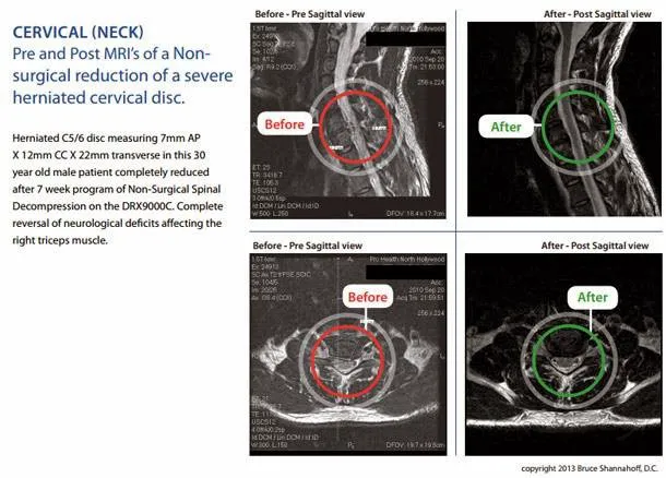 Dr. Bruce Shannahoff, D.C. Picture 5