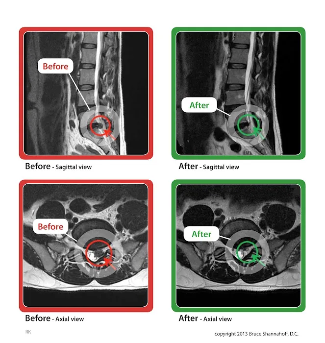 Valley Spinal Decompression Center Picture 1