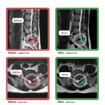 Valley Spinal Decompression Center