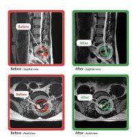 Valley Spinal Decompression Center ico