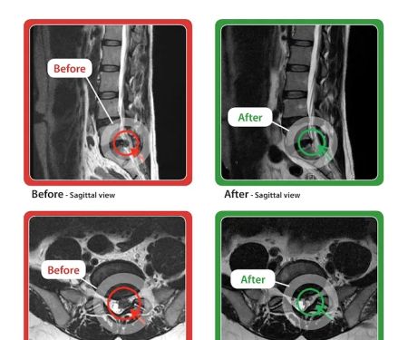 Valley Spinal Decompression Center