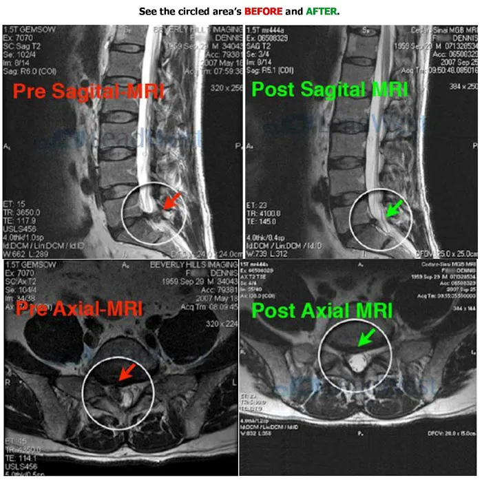 Valley Spinal Decompression Center Picture 5