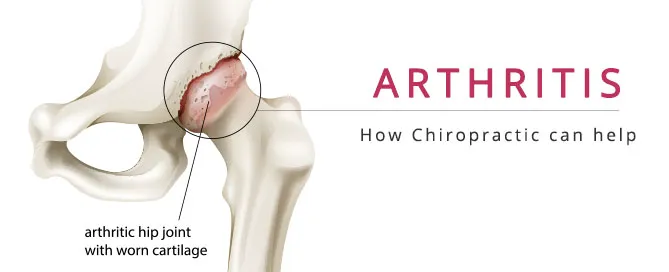 ChiroSport Health Center Picture 10