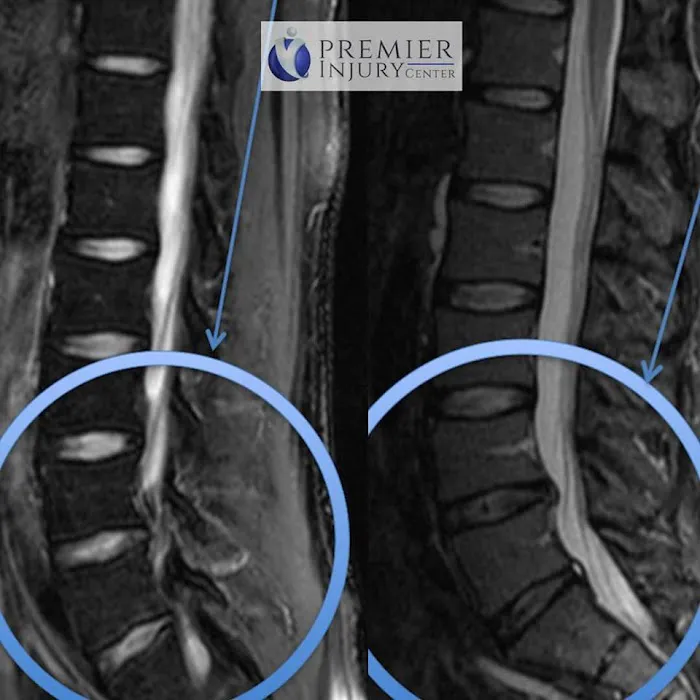 Premier Injury & Health Center Picture 8