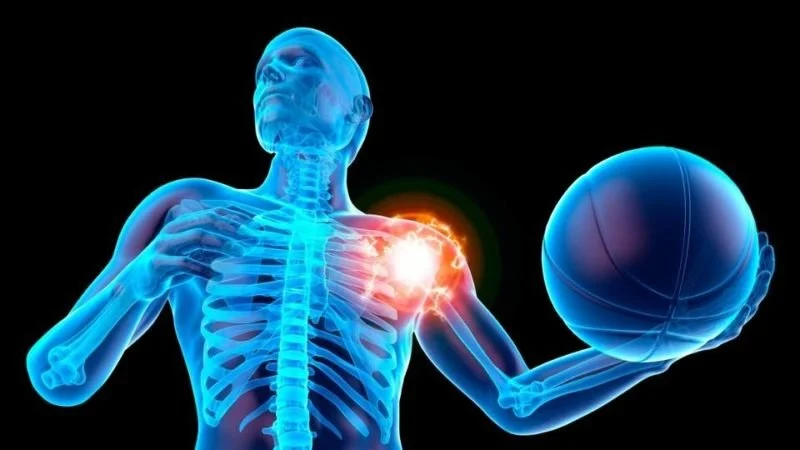 How Chiropractic Adjustments Can Improve Frozen Shoulder Relief