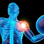 How Chiropractic Adjustments Can Improve Frozen Shoulder Relief