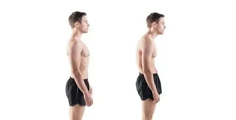 What Causes Posture Correction and How Chiropractors Treat It | Posture Health
