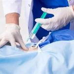 Natural Pain Management for Your Spine - Effective Solutions