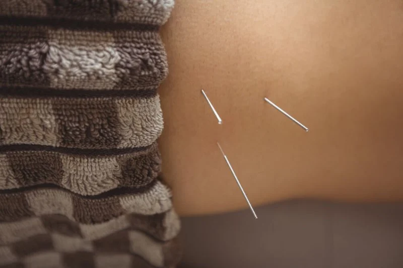 Chiropractic vs Acupuncture for Chronic Pain: Key Differences Explained