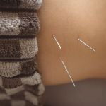 Chiropractic vs Acupuncture for Chronic Pain: Key Differences Explained