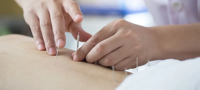 What is the Difference Between Chiropractic and Acupuncture for Chronic Pain?