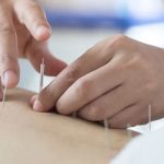 What is the Difference Between Chiropractic and Acupuncture for Chronic Pain?