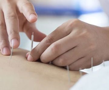 What is the Difference Between Chiropractic and Acupuncture for Chronic Pain?